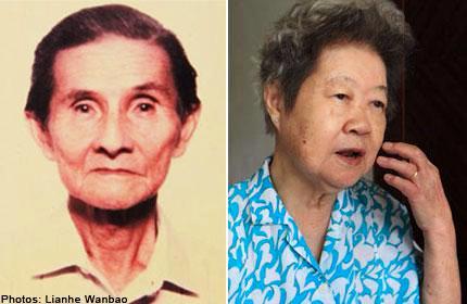 Tewas Saat Minum Susu karena Gigi Palsunya Tertelan